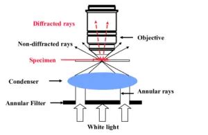 Dark Field Microscopy Principle And Uses Microbe Online