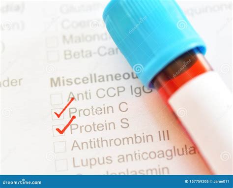 Blood Sample for Protein S and Protein C Test Stock Image - Image of ...