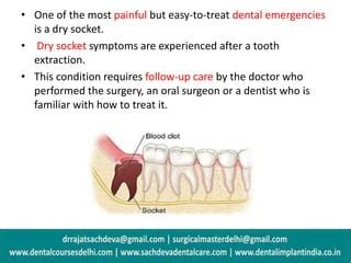 Dry Socket Ppt