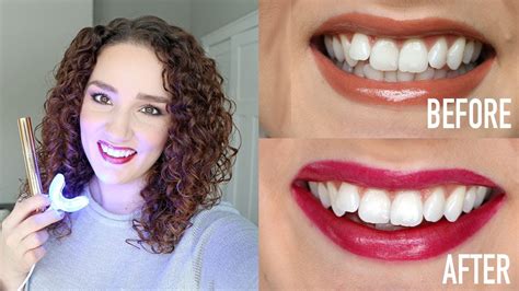 Snow Teeth Whitening Review Best Teeth Whitening For Sensitive Teeth