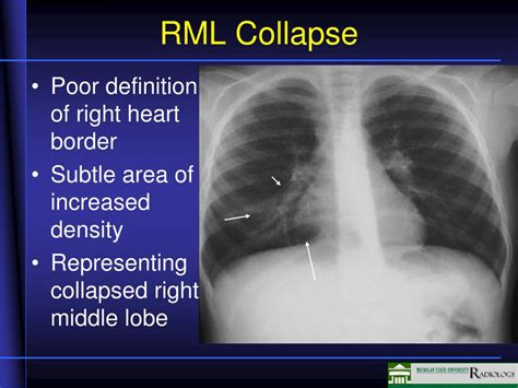 Ppt Airway Disease Powerpoint Presentation Free Download Id1836815