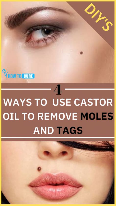 Does Castor Oil Remove Skin Tags - HOWOTREMVO