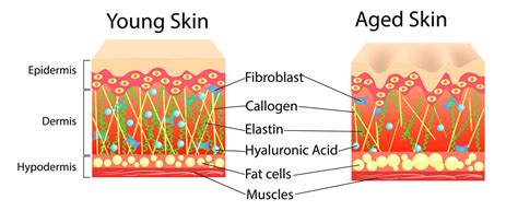 Stages Of Aging Skin