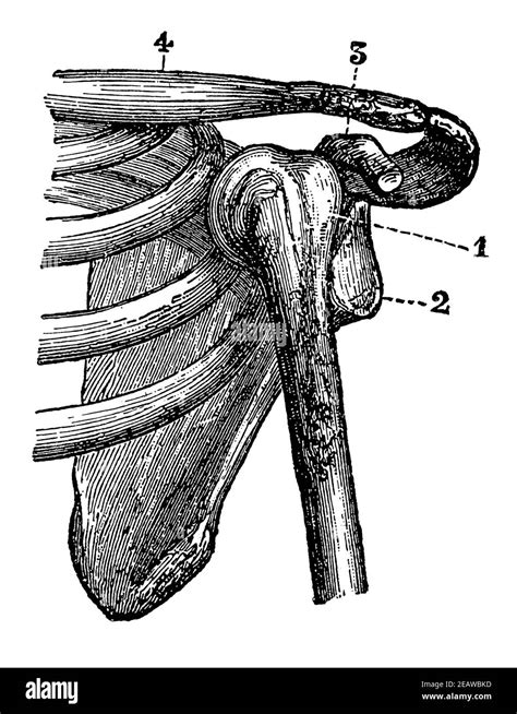 Collarbone Dislocation Hi Res Stock Photography And Images Alamy