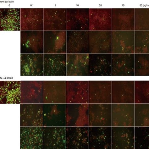 Serial Photographs Of Immunofluorescence Staining Of Ecv304 Cells