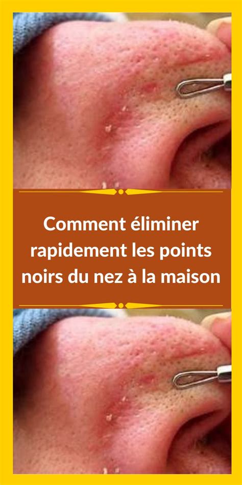 Comment éliminer rapidement les points noirs du nez à la maison Point