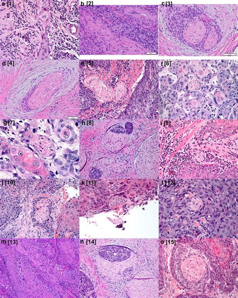 Photomicrographs For Questions In Survey Section I Image Question Download Scientific Diagram