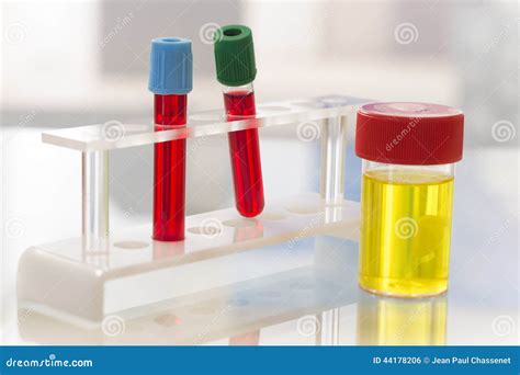 Laboratory Sterile Urine Sample And Blood Test Stock Photo Image