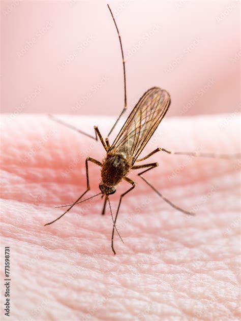 Malaria Infected Mosquito Bite Leishmaniasis Encephalitis Yellow