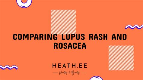 Lupus Rash Vs Rosacea What S The Difference Heathe