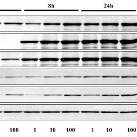 Western blot analysis for transforming growth factor β1 TGF β1 bone