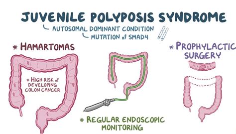 What Do You Know About Juvenile Polyposis Syndrome Day Hereditary