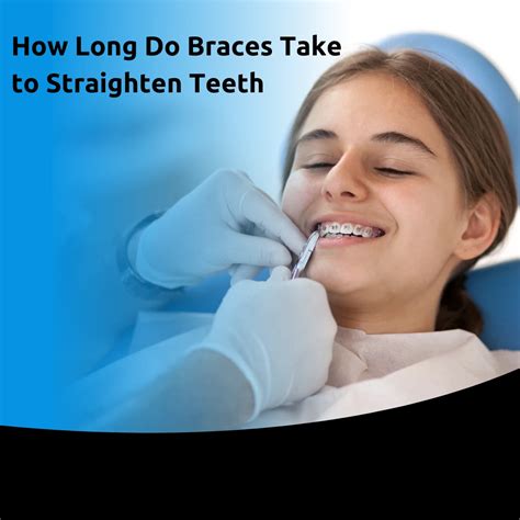 How Long Do Braces Take To Straighten Teeth Learn More