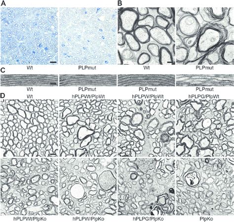 Ultrastructural Cns Myelin Alterations And Neural Pathology In Plpmut