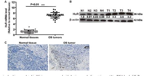 Figure 1 From RNA Binding Protein HuR Promotes Osteosarcoma Cell