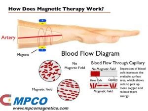 How Magnet Therapy Work - MPCO Magnets