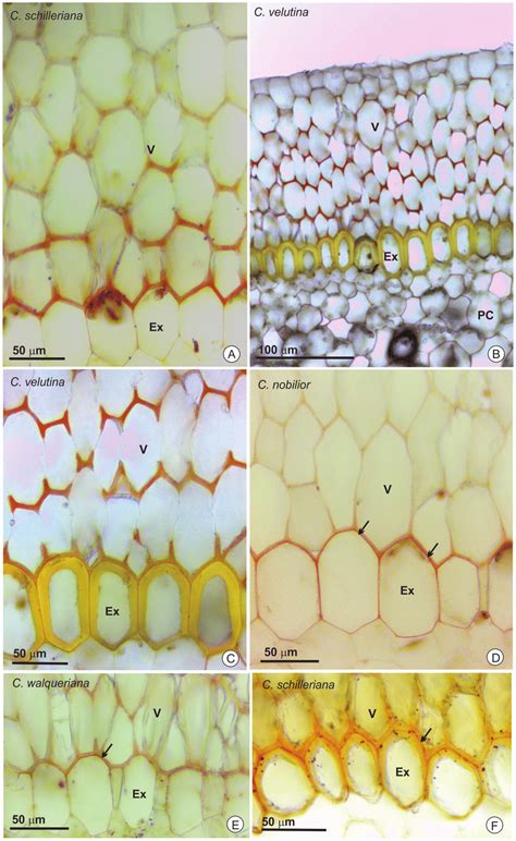 Histochemical test with Sudan III for the detection of lipids in