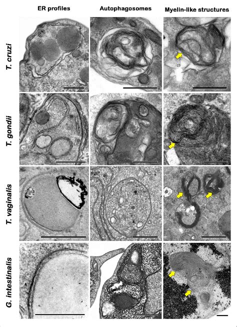 Transmission Electron Microscopy Analysis Of Autophagic Phenotypes