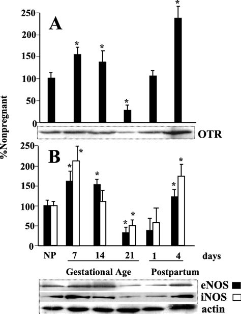 Western Blot Analysis Of A Oxytocin Receptors Otr And B Download Scientific Diagram