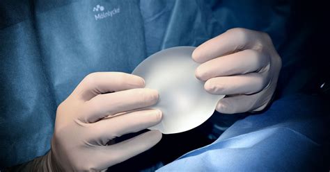 Breast Implants And Cancer Fda Warns Devices May Be Linked To Squamous