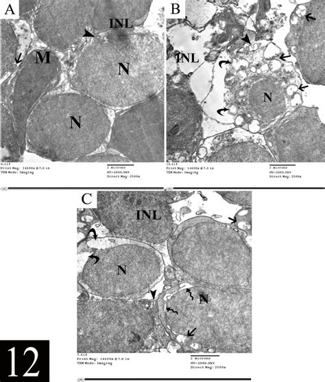 Electron Micrographs Of The Inner Nuclear Layer INL Of Rat Retina