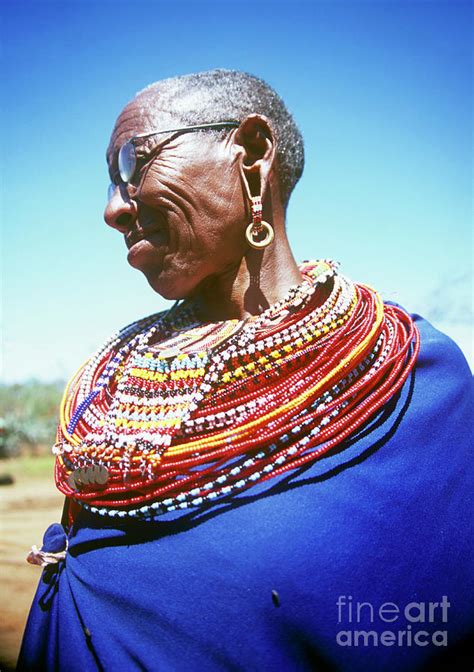 Eye Surgery Patient 3 By Jason Kelvin Science Photo Library