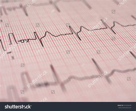 Electrocardiography Ecg Aka Ekg Elektrokardiogramm Measure