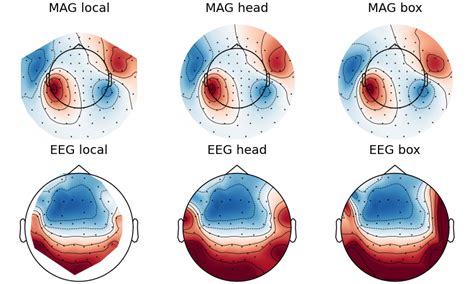 Plotting Topographic Maps Of Evoked Data — Mne 1 9 0 Documentation