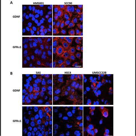 Expression Levels Of Gdnf And Gfrα1 In Human Hnscc Cells Download