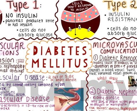 Diabetes Mellitus One-page Outline / Concept Map - Etsy | Concept map ...