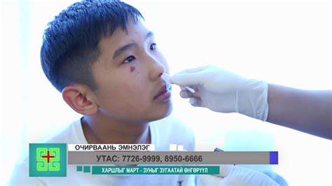 Очирваань эмнэлэг харшлын эмчилгээ - YouTube
