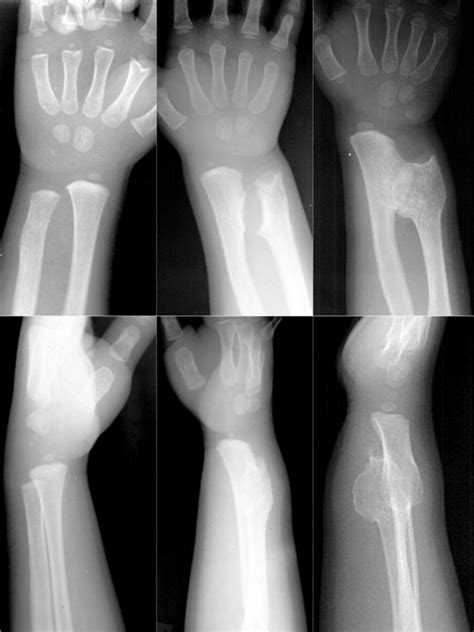 Institut F R Diagnostische Interventionelle Und P Diatrische