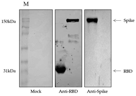 Viruses Free Full Text Rbd And Spike Dna Based Immunization In