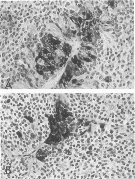 Figure From Analysis Of Pituitary Hormones And Chromogranin A Mrnas