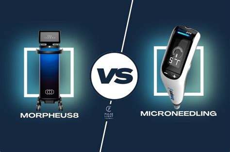 Morpheus8 Vs Microneedling All You Need To Know Pulse Light Clinic