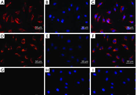 Immunofluorescence Staining Of Fviii And Apom In Eahy926 Cells Fviii