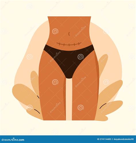 Female Belly Icon Cartoon Style Stock Illustration Cartoondealer