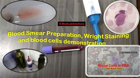 Blood Smear Preparation Wright Staining And Blood Cells Demonstration