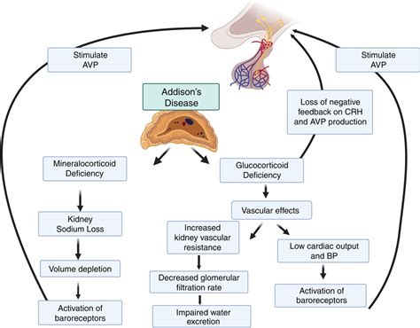 CJASN on Twitter: "The pathogenesis of hyponatremia in endocrine ...