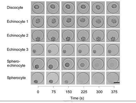 Red Blood Cells Microscope Hypertonic