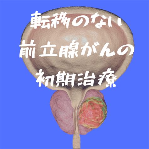 転移がない前立腺がんの初期治療 がんゲノム医療・免疫治療 銀座みやこクリニック院長ブログ