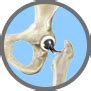 Antibiotic Prophylaxis Protocol After Total Joint Replacement