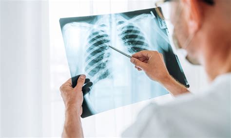 Radiologists Outperform Ai In Identifying Lung Diseases On Chest X Ray