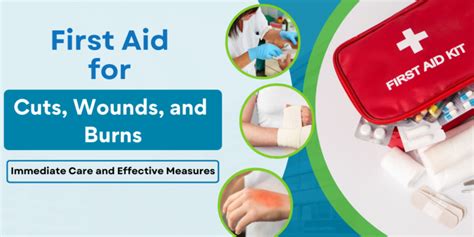 First Aid Tips For Cuts Wounds And Burns