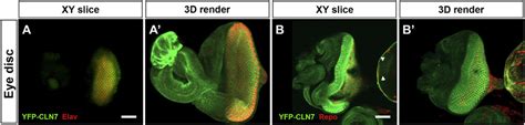 CLN7 Is Expressed In Neurons And Glia In The Developing Visual System