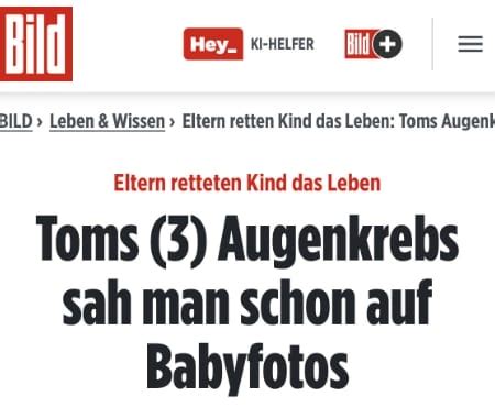 BILD.DE berichtet über das Retinoblastom und die KAKS - KAKS ...