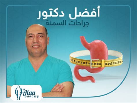 افضل دكتور جراحة سمنه في مصر الدكتور علاء بدوي