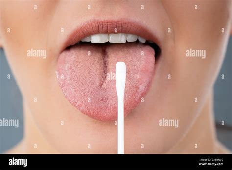 Prueba De Saliva Fotografías E Imágenes De Alta Resolución Alamy