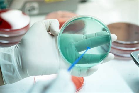 Arthritis Panel Arth Blood Test Goldenpoint Scientific Labs
