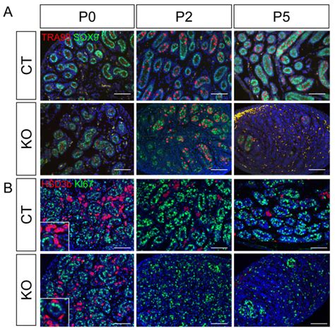 Effects Of Dicer1 Ablation On Differentiation Of Germ Cells Sertoli